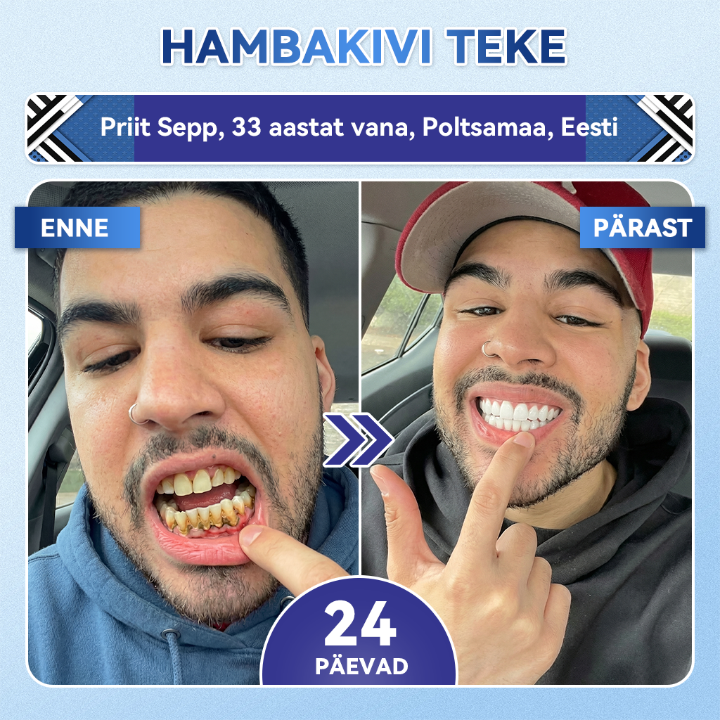 𝐺𝑙𝑖𝑚𝑚𝑒𝑟𝑙𝑦® 𝑇𝑖𝑑𝑒𝑔𝑙𝑢𝑠𝑖𝑏 ℎ𝑎𝑚𝑏𝑎- 𝑗𝑎 𝑖𝑔𝑒𝑚𝑒𝑝𝑎𝑟𝑎𝑛𝑑𝑢𝑠𝑟𝑖𝑏𝑎𝑑 𝑘𝑖𝑖𝑟𝑒𝑠𝑡𝑖 𝑙𝑎ℎ𝑢𝑠𝑡𝑢𝑣𝑎𝑡𝑒 𝑠𝑢𝑢õõ𝑛𝑒 𝑟𝑖𝑏𝑎𝑑𝑒𝑛𝑎🥑🥑