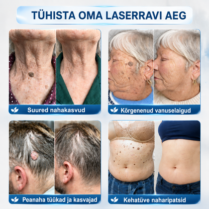 𝐏𝒊𝐜𝐝𝒐® 7-𝒑ä𝒆𝒗 𝑷𝒍𝒆𝒌𝒊𝒆𝒆𝒎𝒂𝒍𝒅𝒖𝒔 𝑨𝒓𝒎𝒊𝒅𝒆 𝒗ä𝒉𝒆𝒏𝒅𝒂𝒎𝒊𝒏𝒆 𝑷𝒍𝒊𝒊𝒂𝒕𝒔💗💗(Zero Pain, Zero Scars rullik)💪